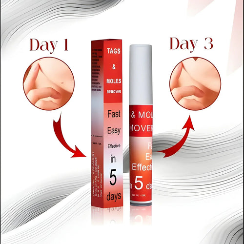 DermaClear™ Tags &amp; Moles Remover (🔥 Buy 1 Get 1 Free 🔥)