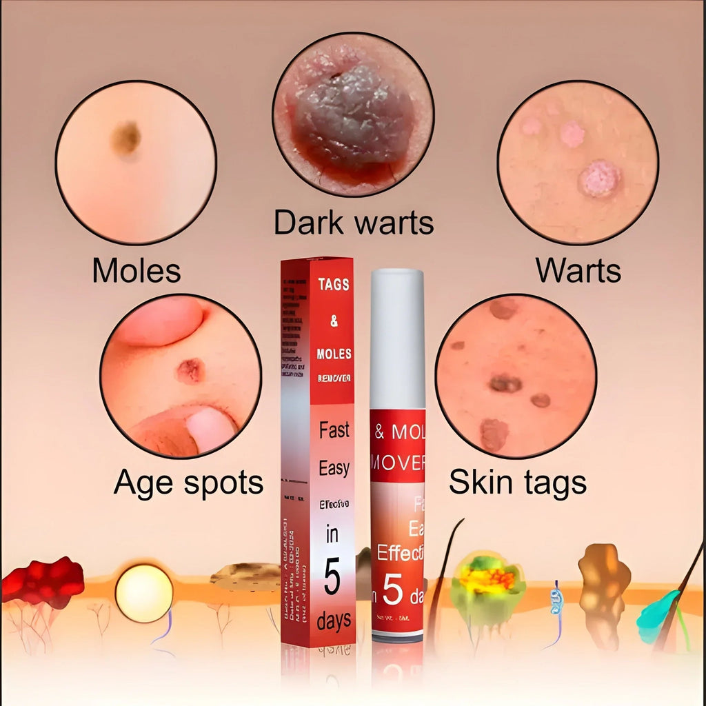 DermaClear™ Tags &amp; Moles Remover (🔥 Buy 1 Get 1 Free 🔥)