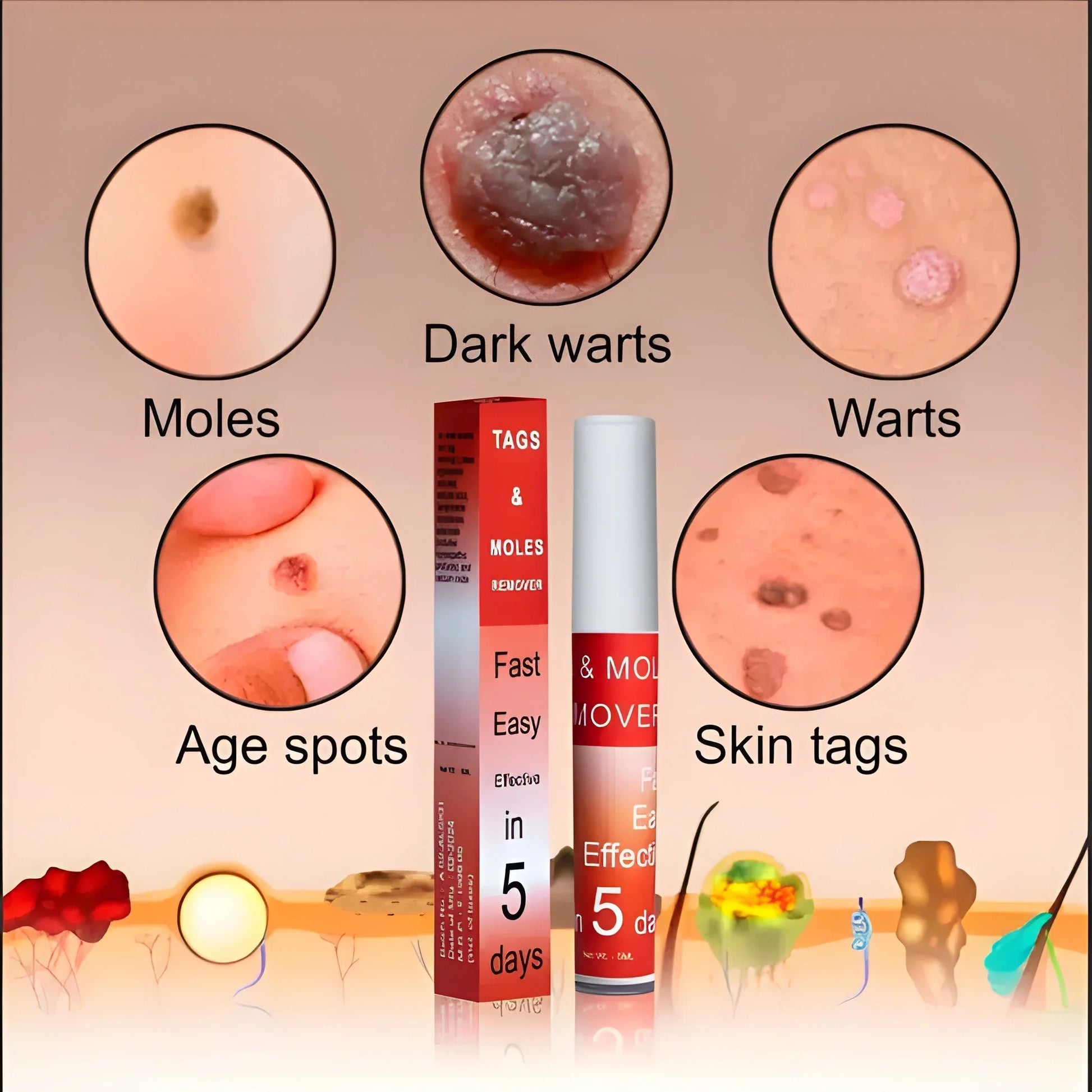 DermaClear™ Tags &amp; Moles Remover (🔥 Buy 1 Get 1 Free 🔥)