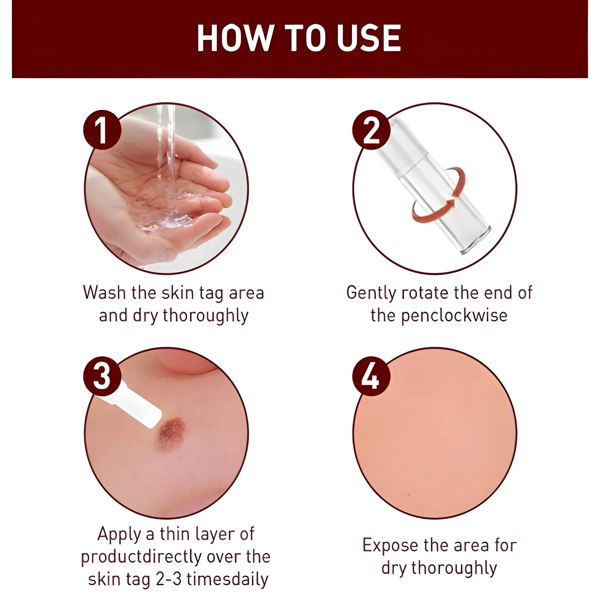 DermaClear™ Tags &amp; Moles Remover (🔥 Buy 1 Get 1 Free 🔥)